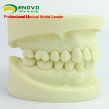 DENTAL05 (12564) Modelo de mandíbula de preparación de cavidades para el entrenamiento dental de estudiantes